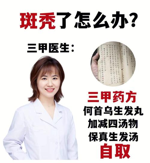 是什么原因导致班秃？有什么解决方法「母女确诊红斑狼疮会遗传吗」 周边旅游